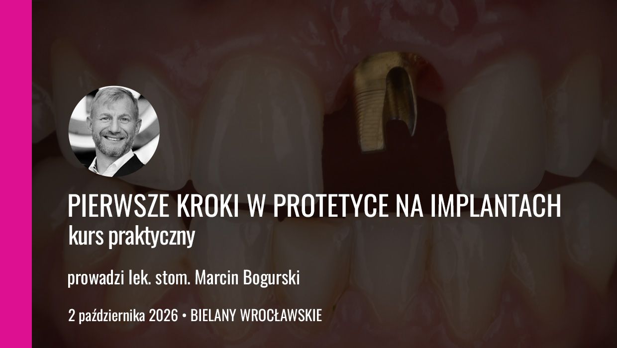 Pierwsze kroki w protetyce na implantach