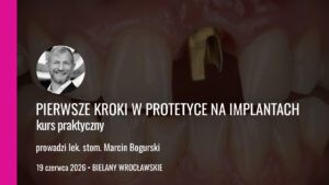 Pierwsze kroki w protetyce na implantach kurs praktyczny edycja 1 19 06 2026