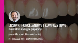 Licówki porcelanowe i kompozytowe minimalnie inwazyjne preparacje edycja 2 28 29 11 2026