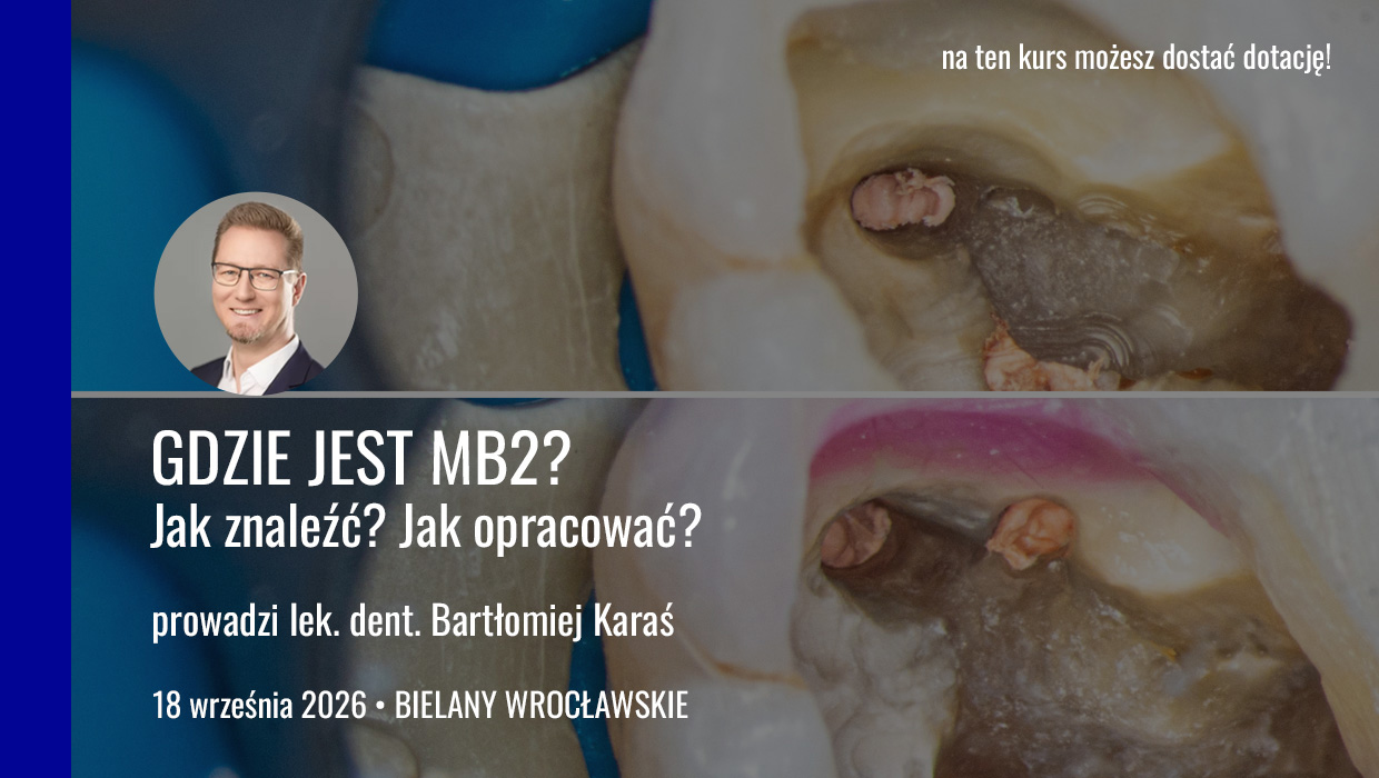 Gdzie jest MB2?